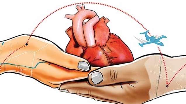 heart-transplant-1